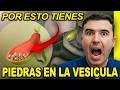 ¡Cómo revertir las piedras en la vesícula! Elimina los cálculos biliares y protege tu salud