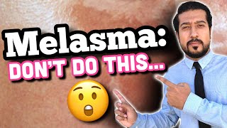 Melasma Mistakes | AVOID THESE 5 MISTAKES for Melasma Success