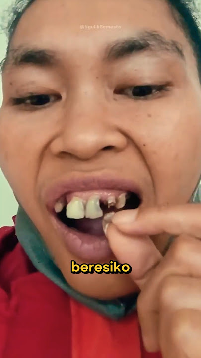 Opening the Bottle Cap