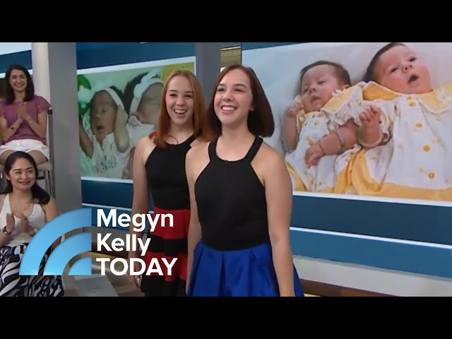 Conjoined Twin Sisters Tell Their Story: ‘Being By Her … It’s So Calming' | Megyn Kelly TODAY class=