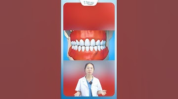 Niềng Răng Có Đau Không | Nha Khoa Minh Châu