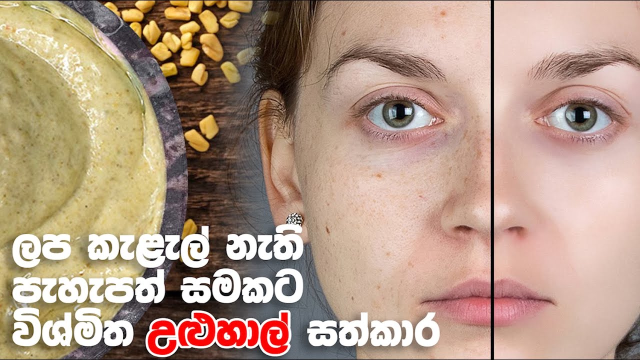 ලප කැළැල් නැති පැහැපත් සමකට විශ්මිත උළුහාල් සත්කාර Fenugreek SKIN
