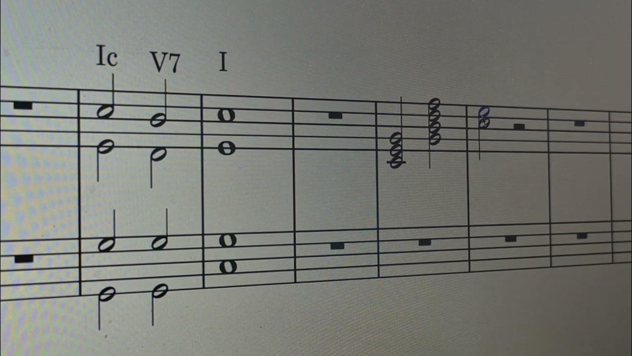 Cadential 6/4 but with Dominant 7th resolution. Cadential 6/4 but with Dominant 7th resolution.