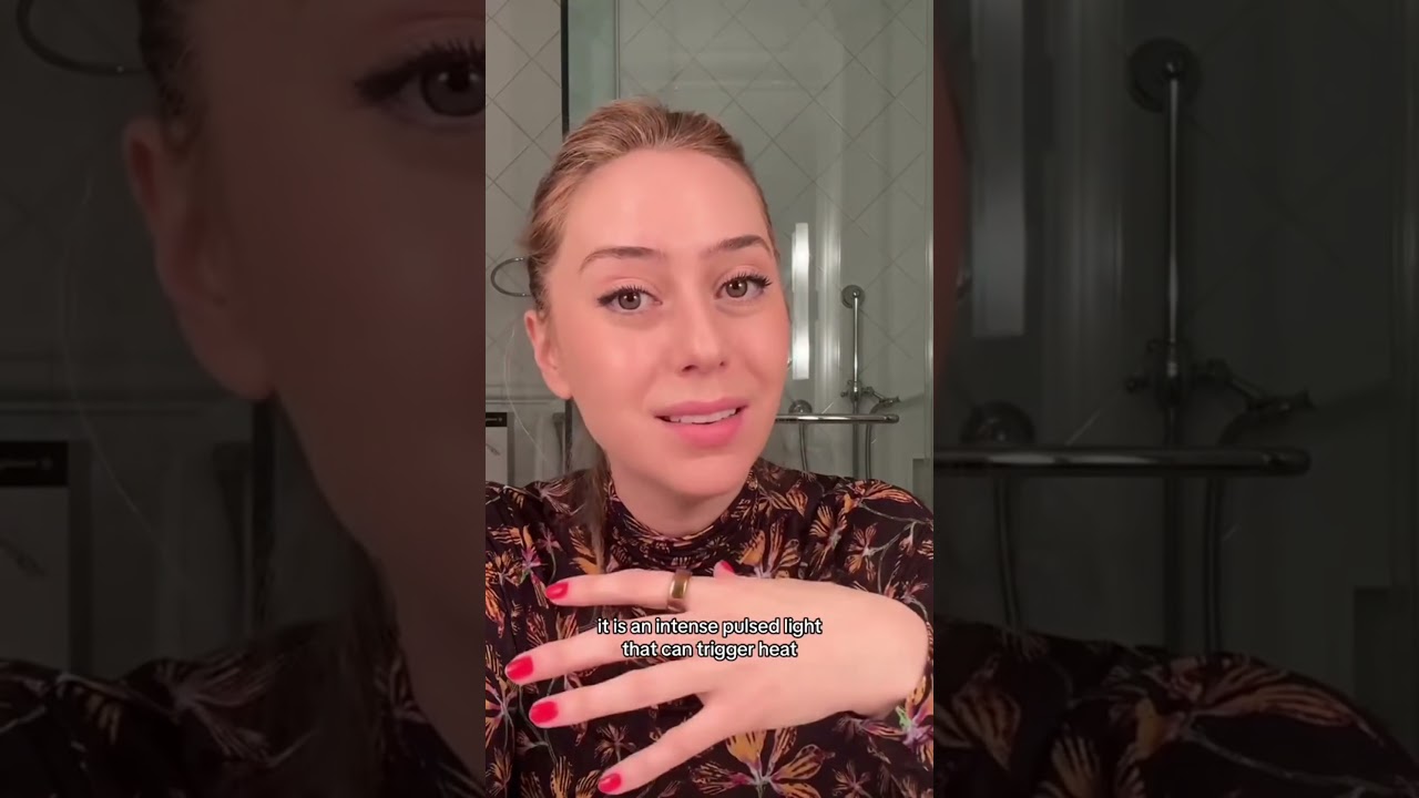 Laser Treatment for Melasma #shorts