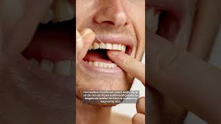 Dişlerinizin Arası Sürekli Siyahlaşıyorsa... Bu 3 Nedeni Bilmelisiniz Şhekimi