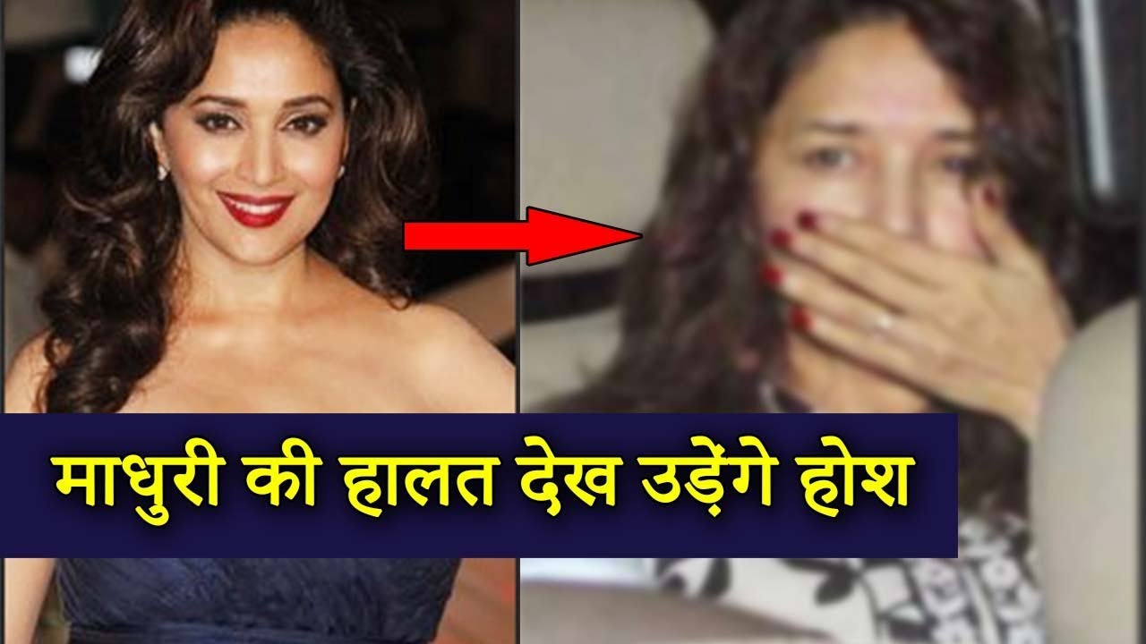 कैसे हुई माधुरी दीक्षित की ये हालत, Madhuri Dixit Without Makeup Pics