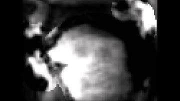 Cornell Speech Imaging Group: Real-time MRI