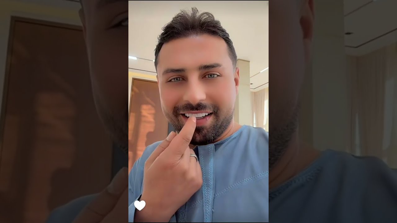 وأخيرا ريتشو و ننوش شوفو صدمة ريتشو نكسر سن سنود 😱ننوش بدءت بتجهيز المكبوس الكويتي كتير متحمسين 😋