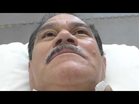 ACUPUNTURA FACIAL PARALISIS FACIAL