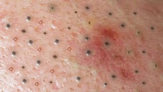 Satisfying and Relaxation with SURI NGUYEN Beauty Spa Video #421