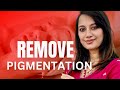             how to remove pigmentation