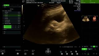 Uông Thị Thúy 1991