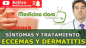 ¿Por qué de repente tengo un brote de eczema?