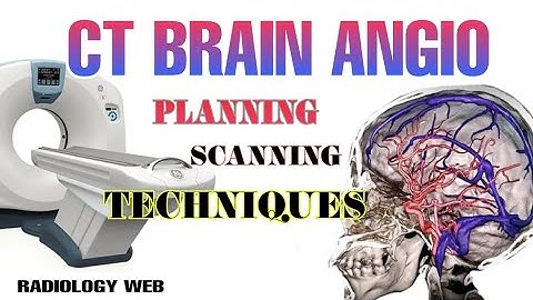 ct brain angio.. procedure, planing, technique full video