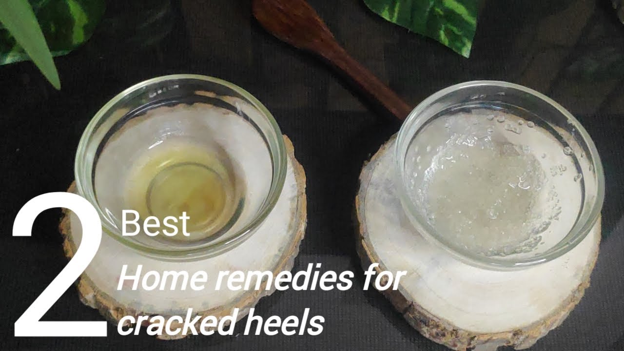 Bid adieu to cracked heels with these easy home remedies | Tips News | Zee  News