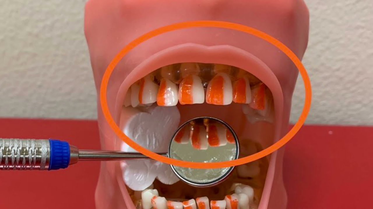 Clinician Clock Positions YouTube