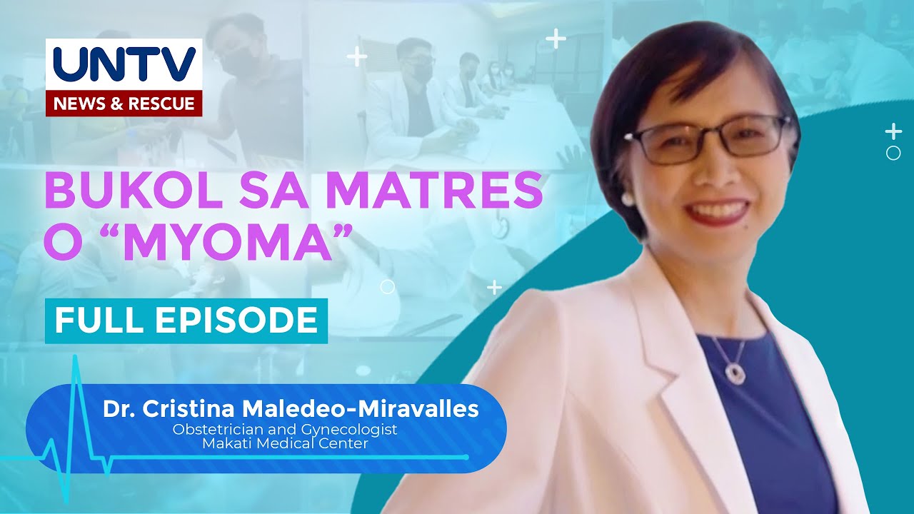 Uterine Fibroids o 'Myoma' bakit hindi dapat katakutan; madaling gumaling kung maaagapan