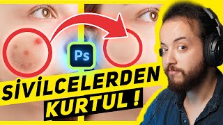 Adobe Photoshop Ile Sivilce Temizleme Nasıl Yapılır? En Basi̇t Yöntem