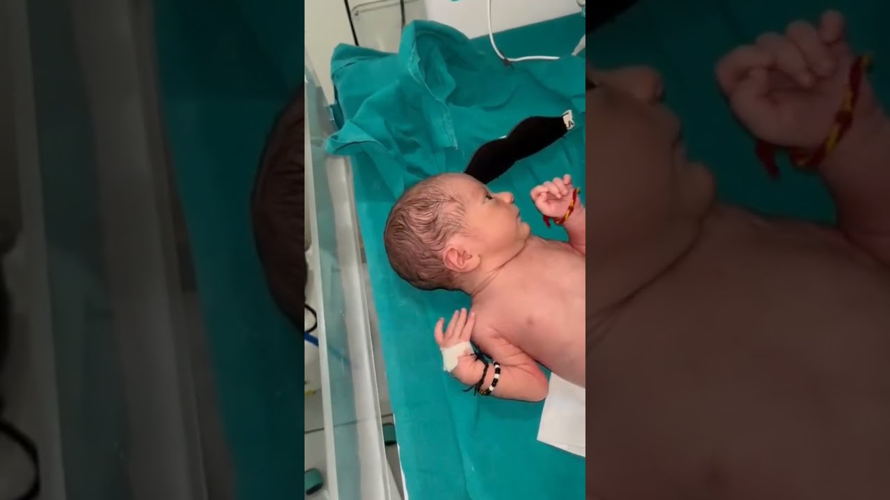  Just Born Baby With Fast Hand Movements So Cute Active Newbornbaby Afterdelivery