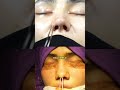 Juraev Khodijon ПЛАСТИЧЕСКИЙ ХИРУРГ  IBATOV'S  CLINIC Toshkent Olmazor Oltinsoy 5