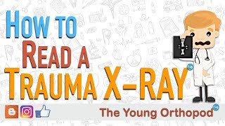 How to Read an X RAY (Trauma Radiograph) - The Young Orthopod