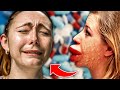 10 Scariest Allergic Reactions Ever