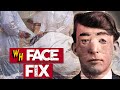 The Untold Story of the First Plastic Surgery