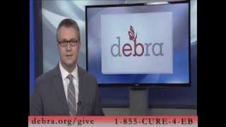 Support debra of America with Michael Benny - Help Find a Cure for Epidermolysis Bullosa