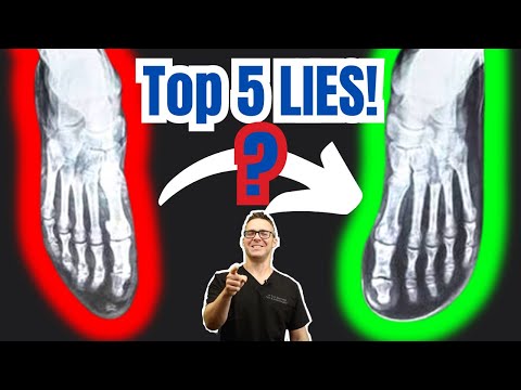 Top 5 Barefoot Shoes LIES! [Plantar Fasciitis, Bunions & Flat Feet]