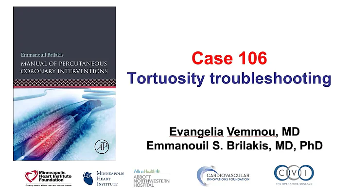 Case 106: PCI Manual - Tortuosity troubleshooting