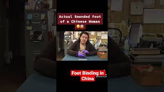 Actual Bounded Foot Of A Chinese Woman 