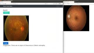 Eyeai Pytorch Hack Demo