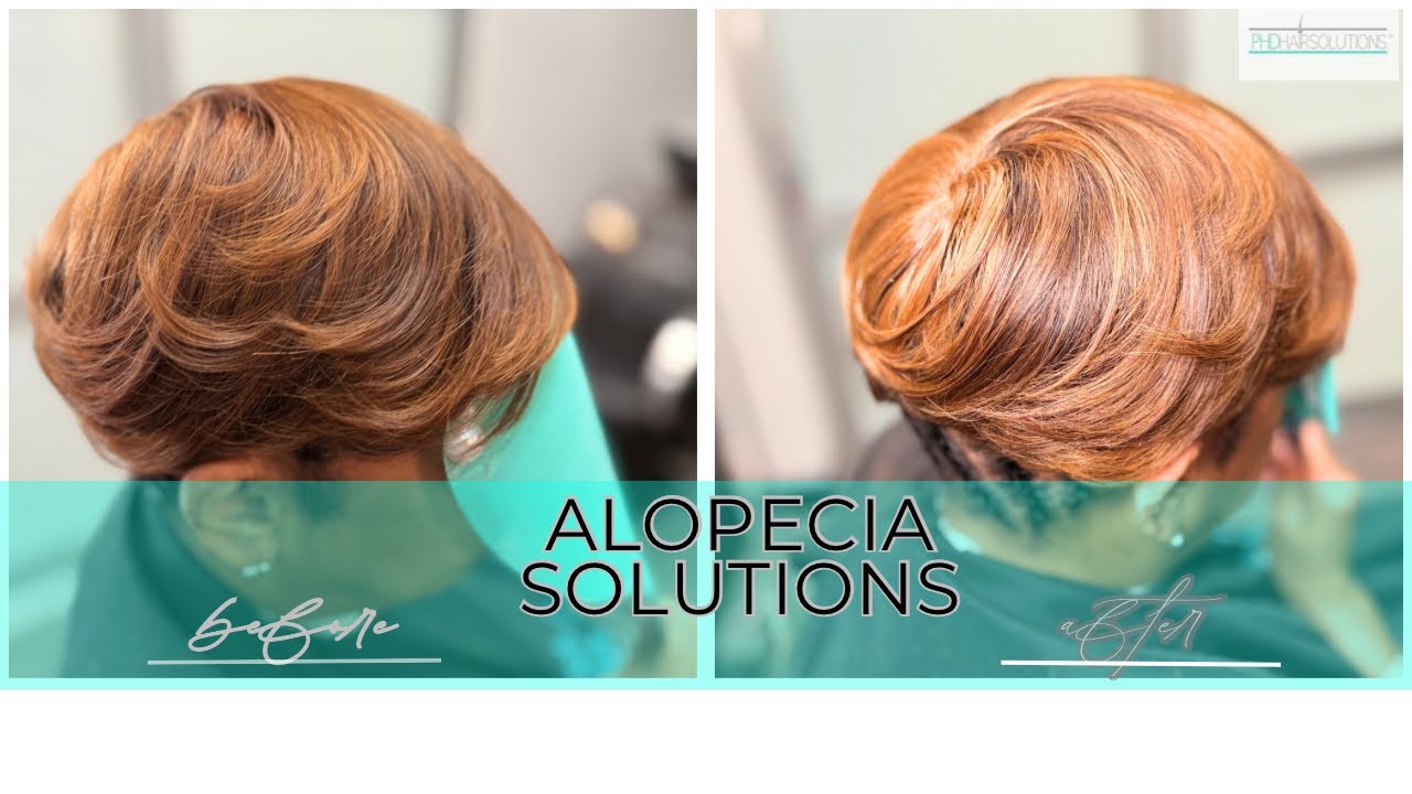 Custom Hybrid Topper Creation + Application | Seamless Alopecia Solution