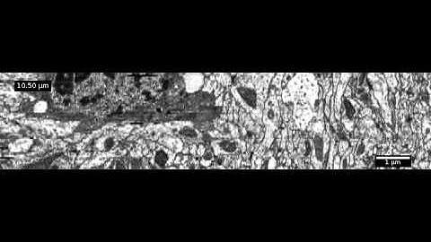 abd-crop2-elastic-reslice.mov