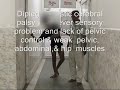 Elder children with cerebral palsy managed by SEMLS  by OSSCS Concept