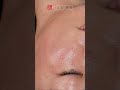 Secret Japanese Skincare Massage Kobido