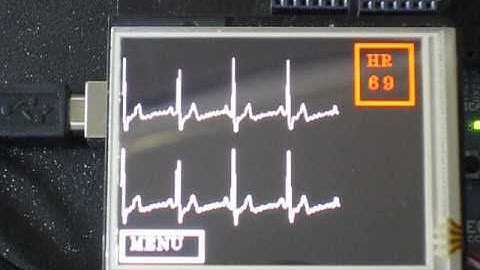 Demo of Two ECG Waveform with real time Heart Rate Measurement using Arduino and Touch shield