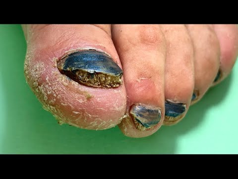 Скрывать😳 или исправлять, что делать? Педикюр