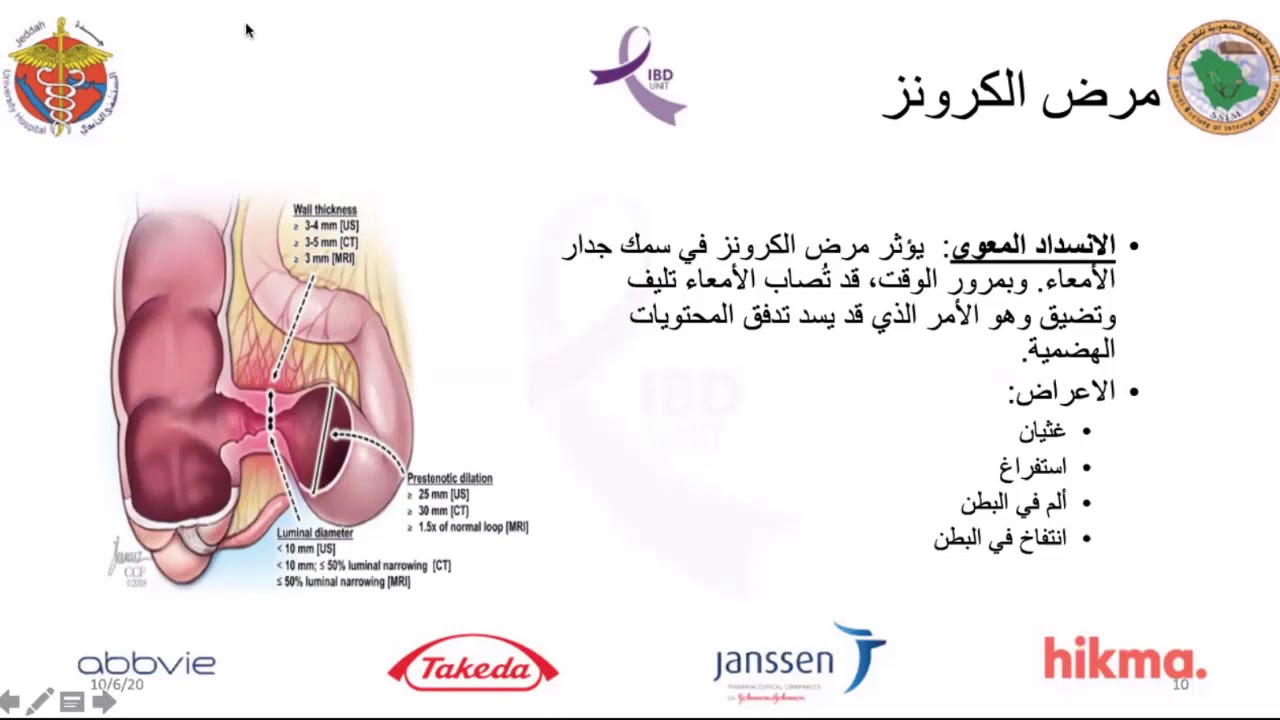 د.عبدالعزيز سليم استشاري الجراحة العامة وجراحة القولون محاضرة متى يصبح التدخل الجراحي مناسبا