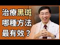 肝斑或黑斑，哪種治療方法最有效？哪種方法最不會復發？