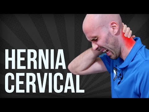 HERNIA DISCAL cervical EJERCICIOS para para aliviar el DOLOR