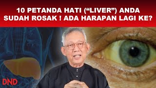 10 PETANDA HATI (LIVER) ANDA SUDAH ROSAK! ADA HARAPAN LAGI KE?