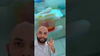 Pyridium Na Urina Entenda O Que É, Para Que Serve E Como Afeta Os Exames