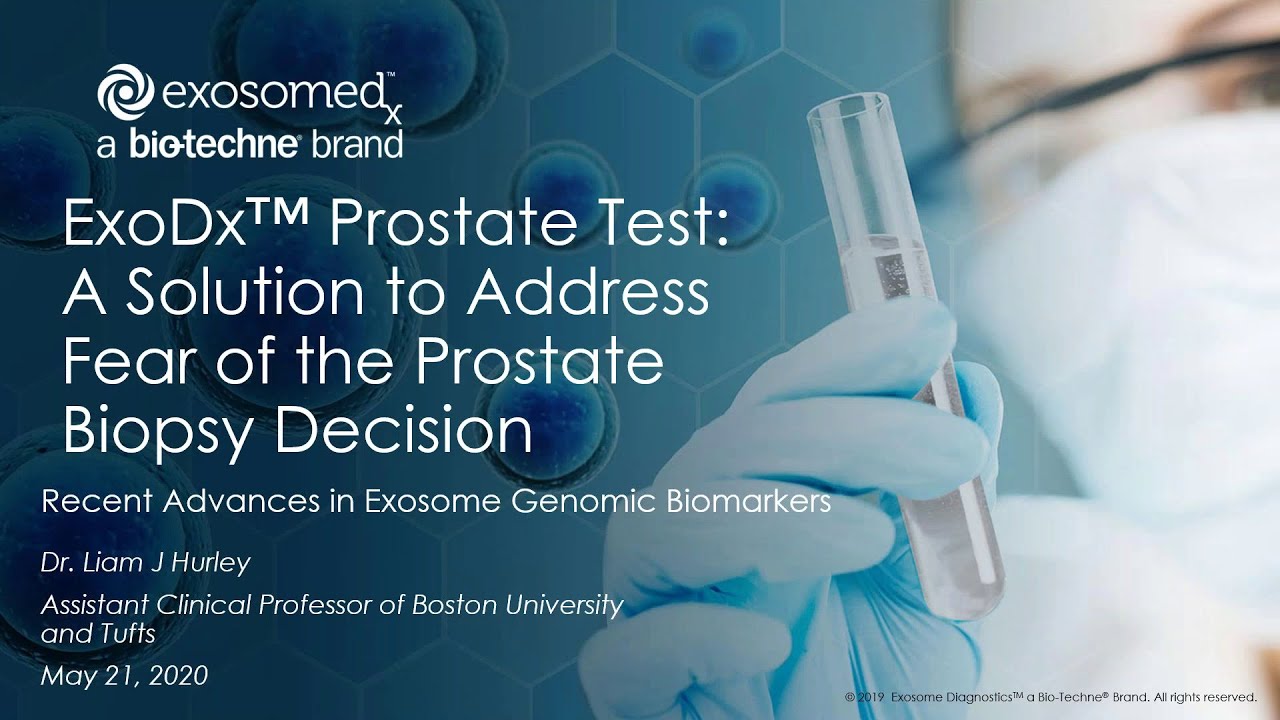 ExoDx™ Prostate Test - A Solution to Address Fear of the Prostate ...