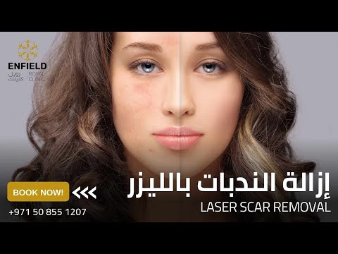إزالة الندبات بالليزر في دبي وأبو ظبي والشارقة والعين إزالة الآفات والندبات إنفيلد رويال كلينك