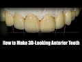 How to make 3dimensional looking anterior teeth