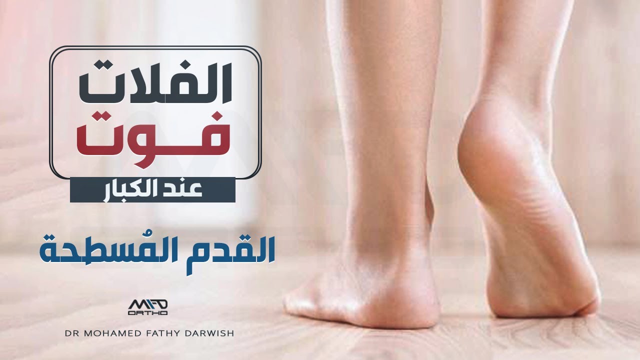 الفلات فوت عند الكبار | الأعراض الأسباب والعلاج