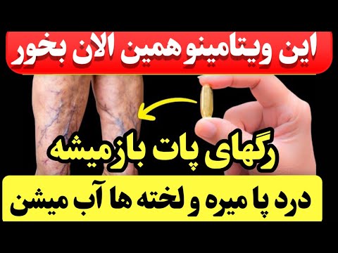 مراقب باشید اگه این ۵ علامتو در پاهات داشتی فورا این ویتامینو بخور لخته ها آب میشن