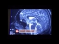 Cerebro enamorado - Documental de Discovery Sciencie