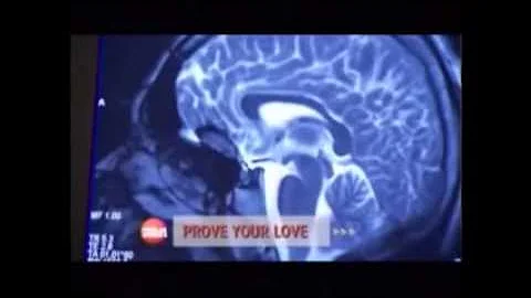 ¿Qué parte del cerebro controla el amor?